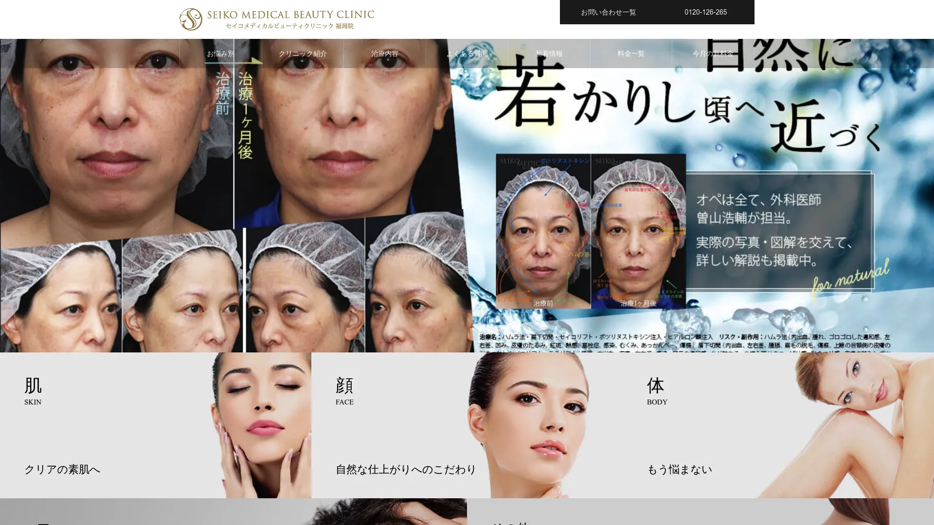 イソトレチノイン処方が安いおすすめクリニック17